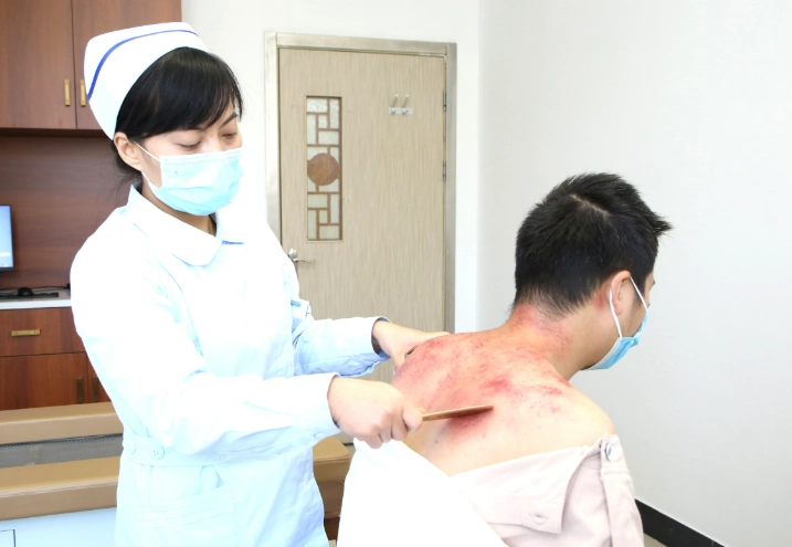 刮痧護理方法 刮痧護理方法