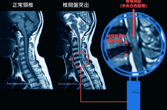 頸椎穴位按摩