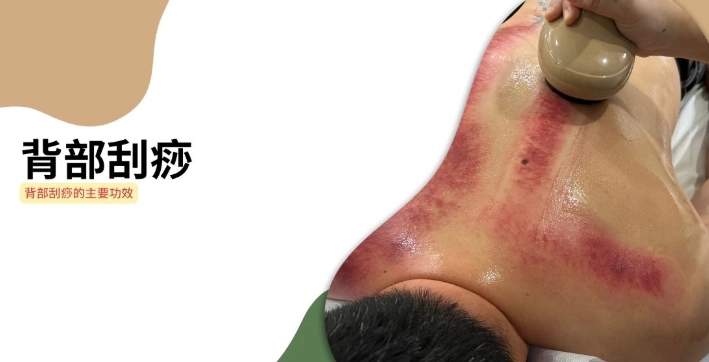 刮痧顏色意義