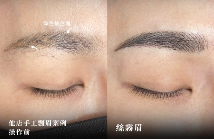 飄眉持久性 飄眉持久性