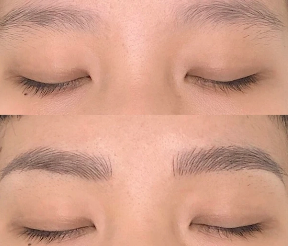 飄眉風險 飄眉風險
